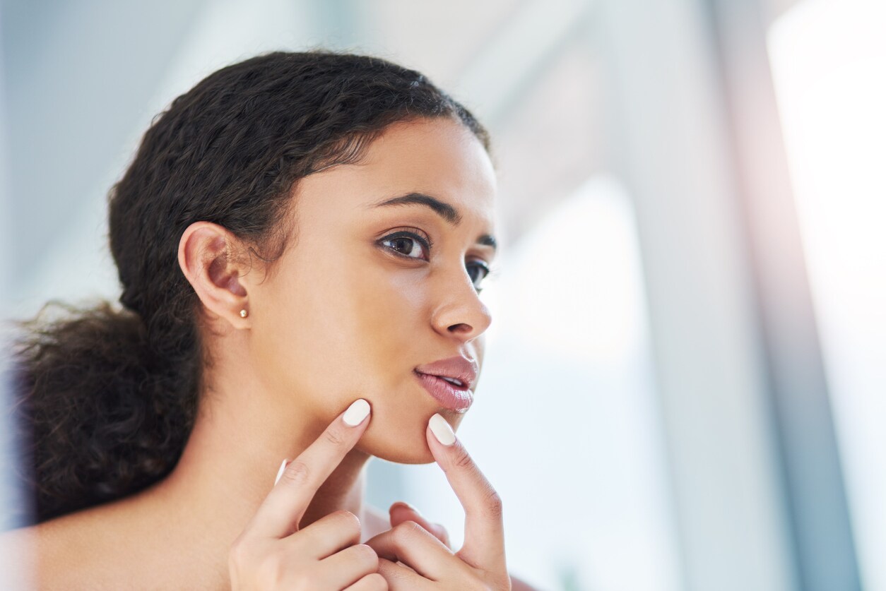 Kin-acne, waarom krijg je het en hoe kom je er vanaf? - Margriet ...