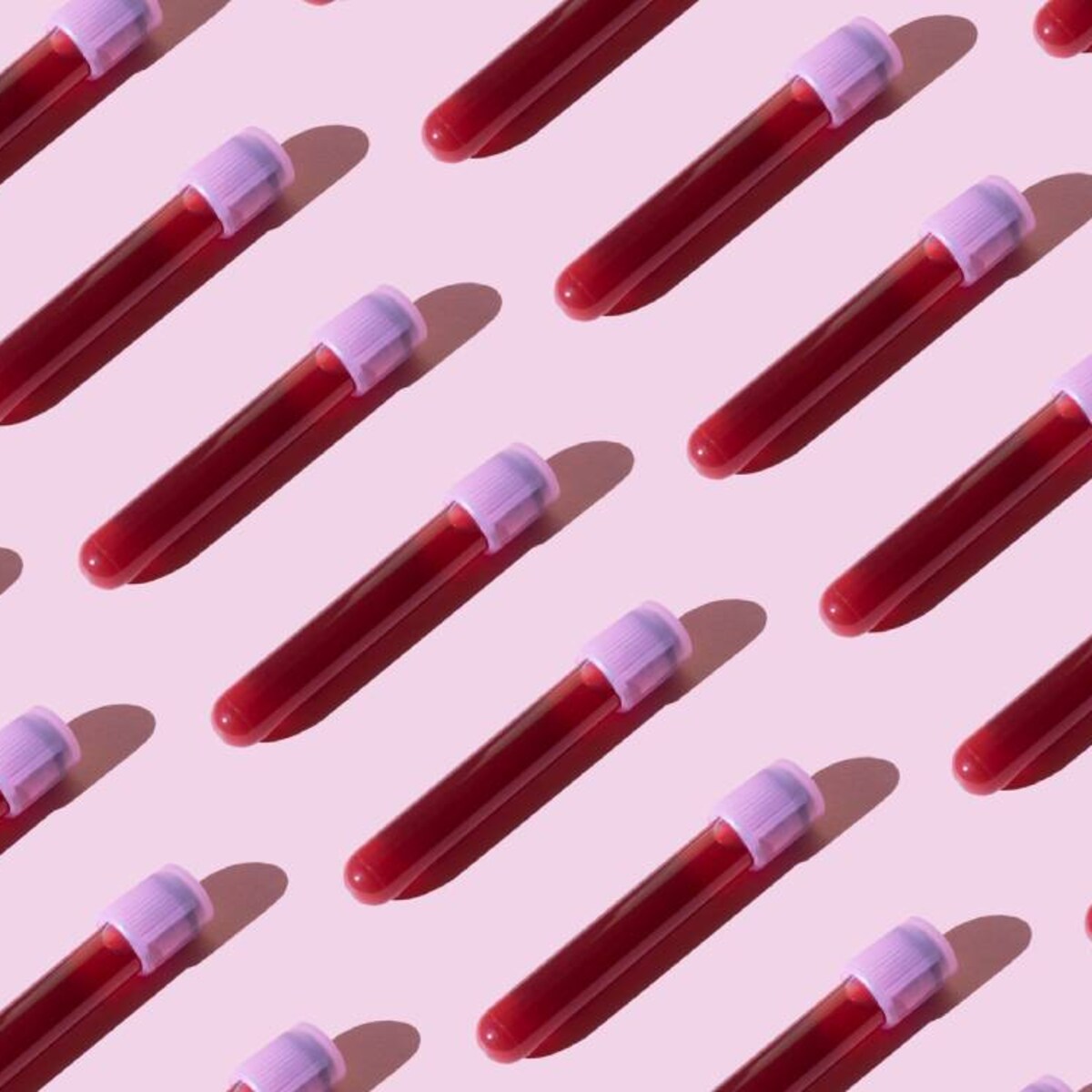 kosten bloedonderzoek cholesterol