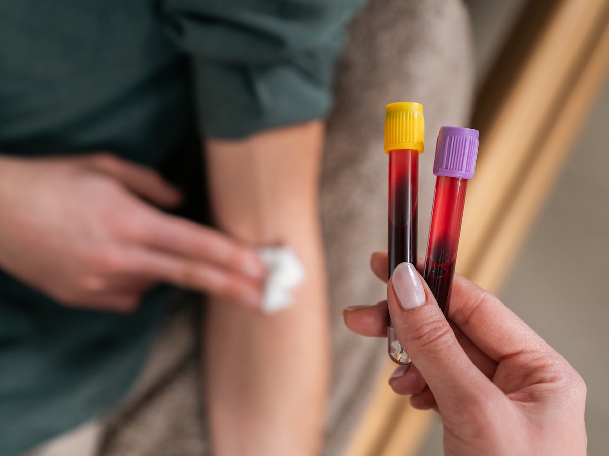 moet je nuchter zijn voor bloedprikken suiker